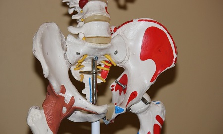 Hip Impingement
