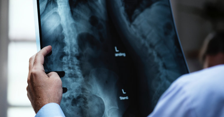 Why you can’t always trust an MRI scan